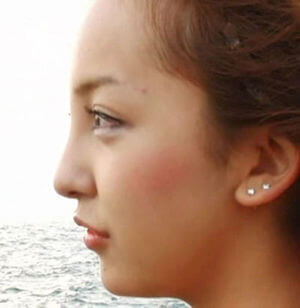 マツコ会議で整形したライオンの鼻の国民的女優は果たして誰だ!