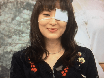 鈴木杏樹の眼帯姿画像あり。これを見たネットの声