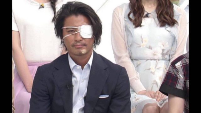 鈴木杏樹の眼帯姿画像あり。これを見たネットの声