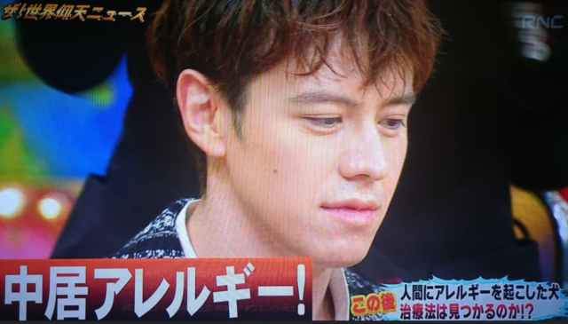 ウエンツ瑛士が中居アレルギーと発言!!先生も認めた!