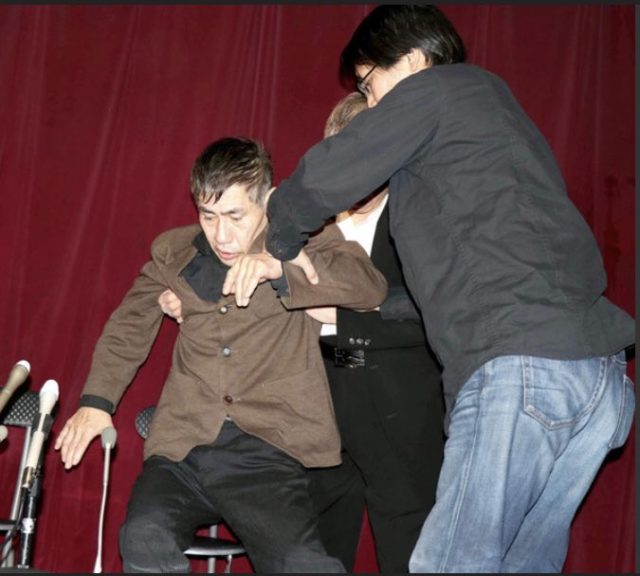 エスパー伊東の病気は右変形性股関節症 脳梗塞・心筋梗塞の原因にも