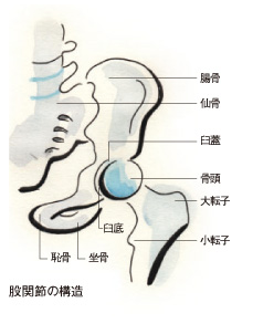エスパー伊東の病気は右変形性股関節症 脳梗塞・心筋梗塞の原因にも