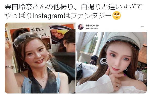 栗田玲奈がインスタ投稿させた手術動画や理由が・・・・