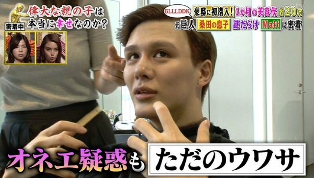 マット（matt）桑田が整形外科って！？整形ではなくメイクと加工で作り上げた件！！