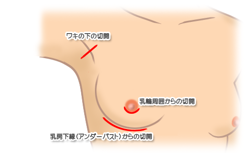 ハラがヌーブラ状態で歌う（テレ東音楽祭）動画・画像がヤバい！！