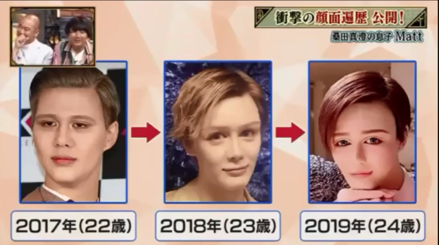 マット(matt)桑田が整形外科って!?整形ではなくメイクと加工で作り上げた件!!