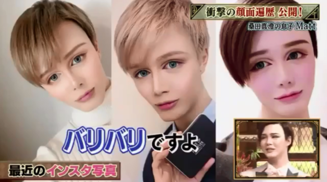 マット(matt)桑田が整形外科って!?整形ではなくメイクと加工で作り上げた件!!