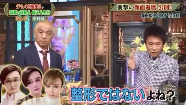 マット(matt)桑田が整形外科って!?整形ではなくメイクと加工で作り上げた件!!