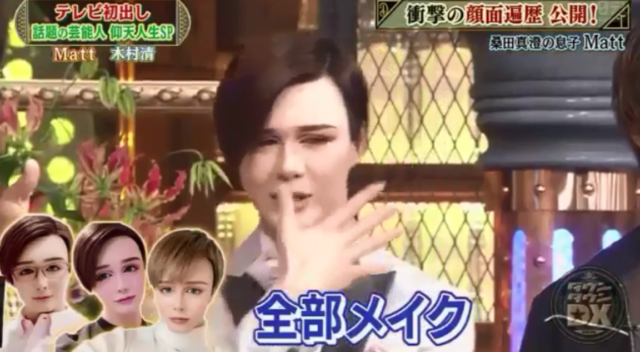 マット(matt)桑田が整形外科って!?整形ではなくメイクと加工で作り上げた件!!