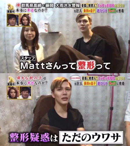 マット(matt)桑田が整形外科って!?整形ではなくメイクと加工で作り上げた件!!
