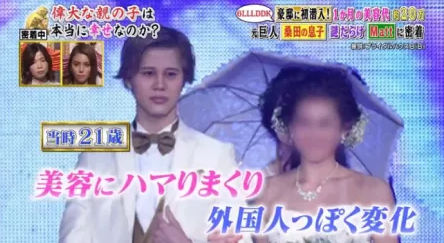 マット(matt)桑田が整形外科って!?整形ではなくメイクと加工で作り上げた件!!