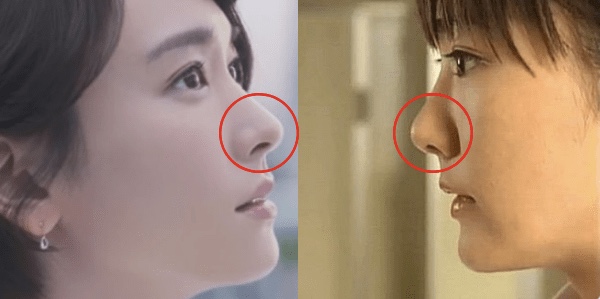 新垣結衣は整形しているの?歯や鼻や目を昔と比較してみた