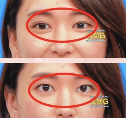 新垣結衣は整形しているの?歯や鼻や目を昔と比較してみた