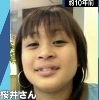 桜井野の花　渚りえ　整形前