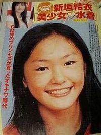 新垣結衣は整形しているの?歯や鼻や目を昔と比較してみた