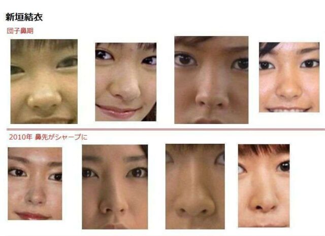新垣結衣は整形しているの?歯や鼻や目を昔と比較してみた